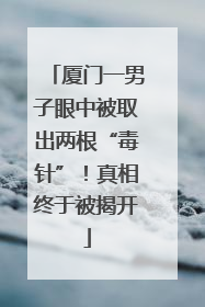 厦门一男子眼中被取出两根“毒针”！真相终于被揭开